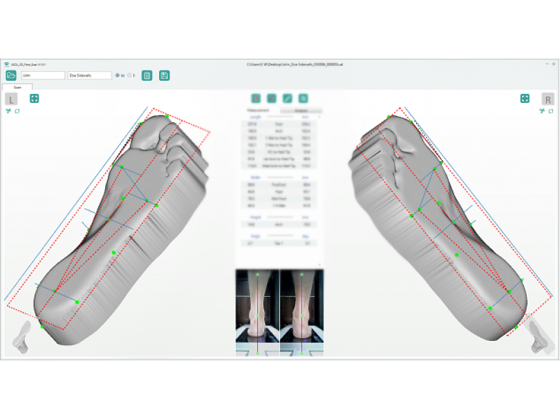 Ортопедический 3D сканер ScanPod3D USOL