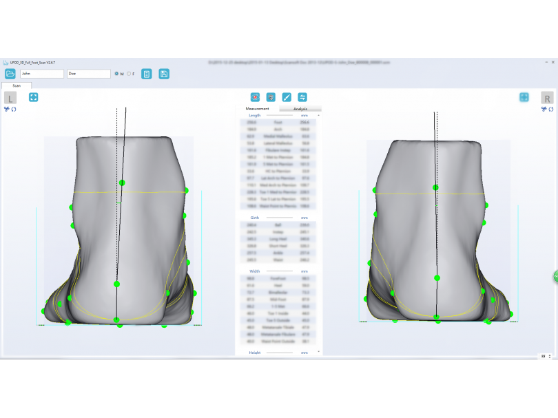 Ортопедический 3D сканер ScanPod3D UPOD-S