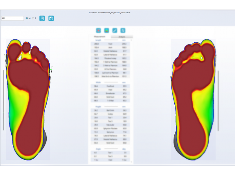 Ортопедический 3D сканер ScanPod3D UPOD-HD