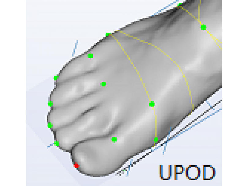 Ортопедический 3D сканер ScanPod3D UPOD-HD